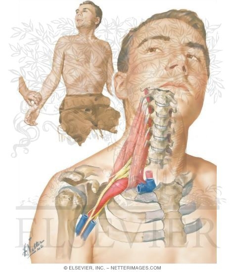 Scalene Muscles and Vessels and Nerves