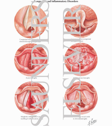 Watermarked preview of labeled image: Congenital and Inflammatory Disorders