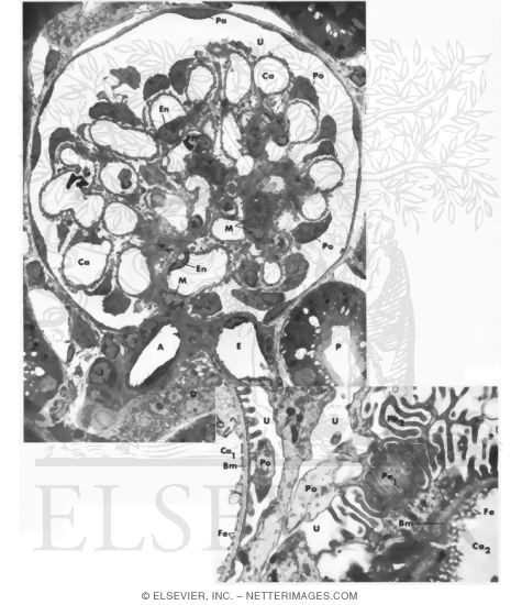 Watermarked preview of unlabeled image: Histology of Renal Corpuscle