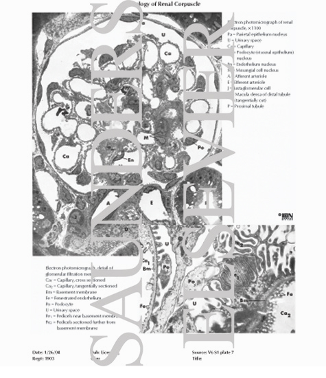 Watermarked preview of labeled image: Histology of Renal Corpuscle