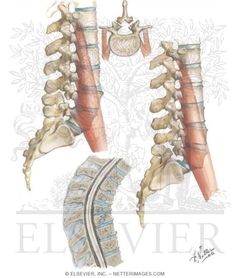 Watermarked preview of unlabeled image: Spondylolysis