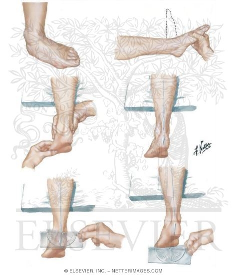 Watermarked preview of unlabeled image: Examination of the Foot and Ankle