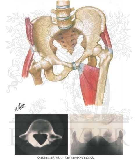 Stress Fracture and Related Disorders of the Pelvis