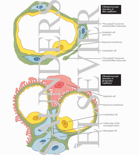 Diabetic Nephropathy: Ultramicroscopic Structure of Skin Capillaries and Glomerular Capillaries