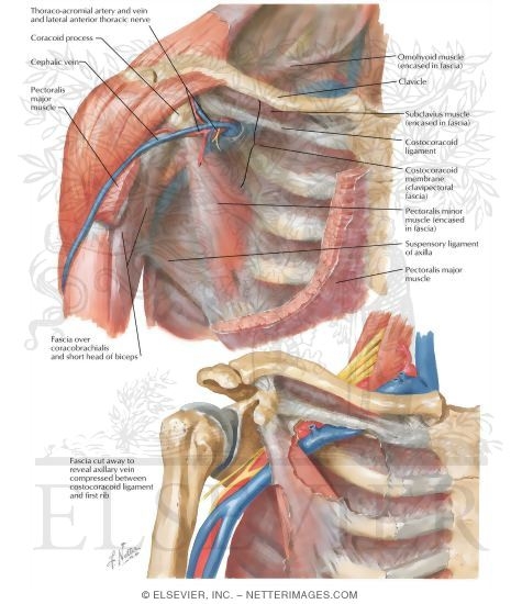 Fascial Sheaths of the Cervicothoracic Region
Neurovascular Compression Syndromes of the Upper Extremity
