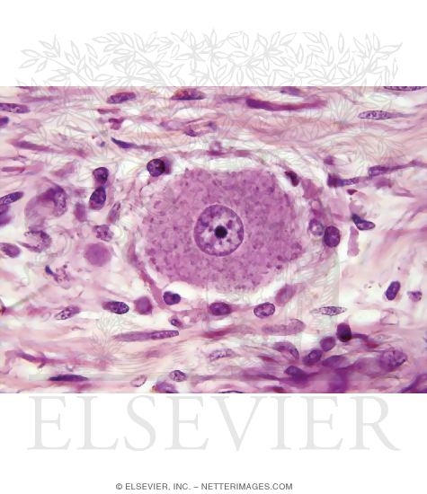 Watermarked preview of unlabeled image: Light Micrograph (LM) of Part of the Dorsal Root Ganglion