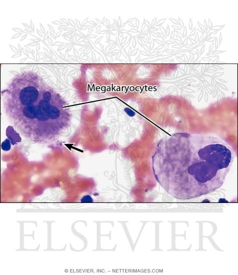 Watermarked preview of labeled image: Light Micrograph of Megakaryocytes In a Bone Marrow Smear