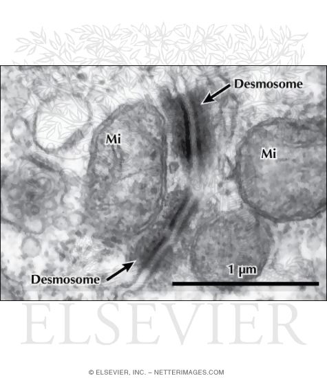 Electron Micrograph of Desmosomes Between Adjacent Epithelial Cells In the Kidney