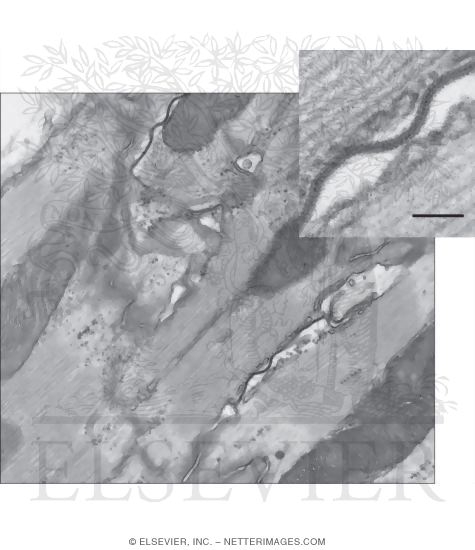 Freeze-Fracture Electron Micrograph Replica of a Gap Junction