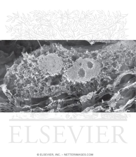 Watermarked preview of unlabeled image: High-Resolution Scanning Electron Micrograph of the Interphase Nucleus of a Skeletal Muscle Fiber