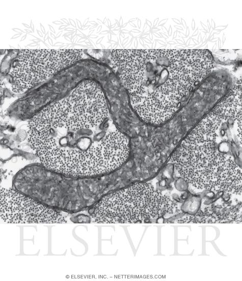 Watermarked preview of unlabeled image: Electron Micrograph of Mitochrondria In a Skeletal Muscle Fiber