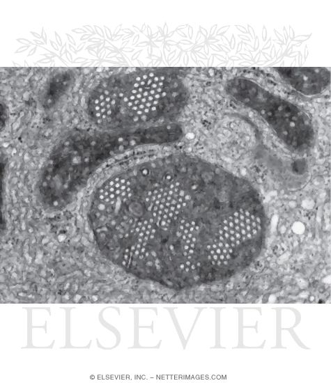 Electron Micrograph of the Mitochondria In a Steroid-Secreting Cell