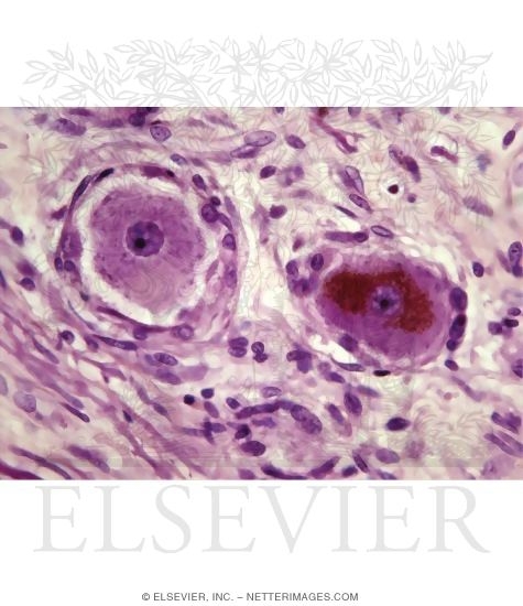 Light Micrograph of Nerve Cells With Cytoplasmic Basophilia