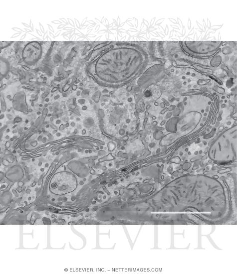 Electron Micrograph of the Golgi Complex In a Hepatocyte