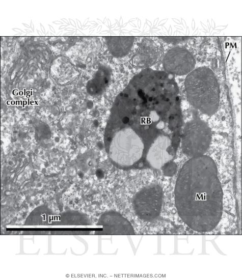 Electron Micrograph of a Tertiary Lysosome