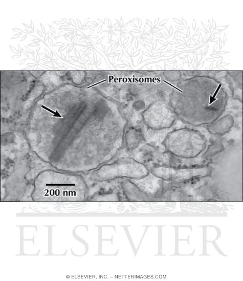 Electron Micrograph of Peroxisomes at High Magnification