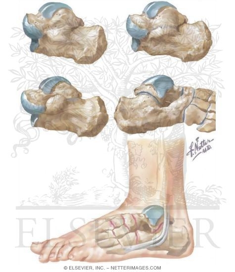 Watermarked preview of unlabeled image: Spastic Flatfoot