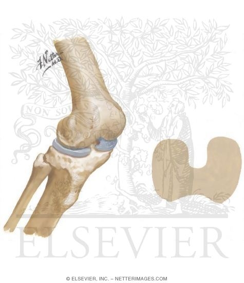 Watermarked preview of unlabeled image: Disorders of the Knee