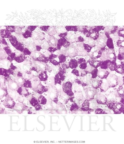 Watermarked preview of unlabeled image: Light Micrograph of the Liver Stained to Show Glycogen In Hepatocytes