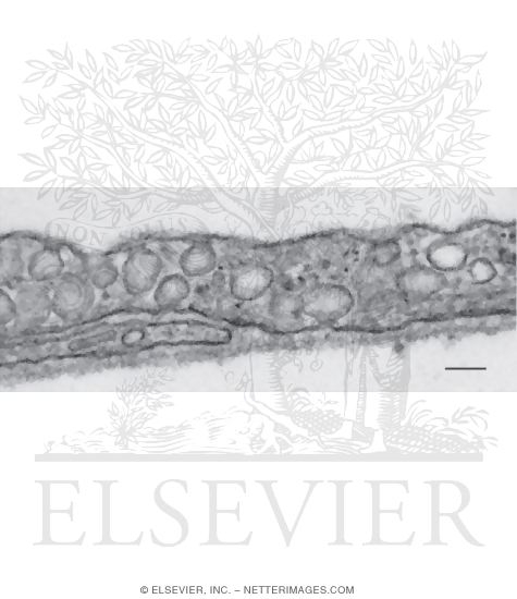 Electron Micrograph of Caveolae and Vesicles at High Magnification