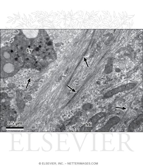 Watermarked preview of labeled image: Electron Micrograph of Intermediate Filaments In a Cultured Cell