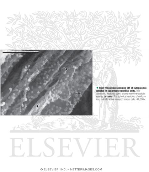 Watermarked preview of labeled image: High-Resolution Scanning Electron Micrograph of Cytoplasmic Vesicles In Squamous Epithelial Cells