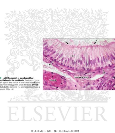 Watermarked preview of labeled image: Light Micrograph of Pseudostratified Epithelium In the Epididymis