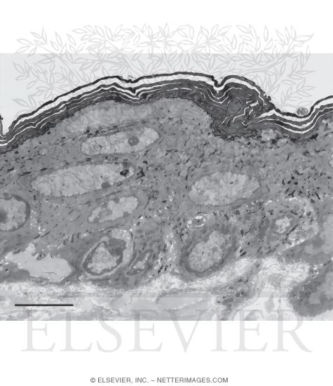 Electron Micrograph of Keratinized Stratified Squamous Eitheliumin Thin Skin