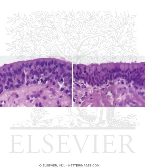 Light Micrographs of Stratified Columnar Epithelia
