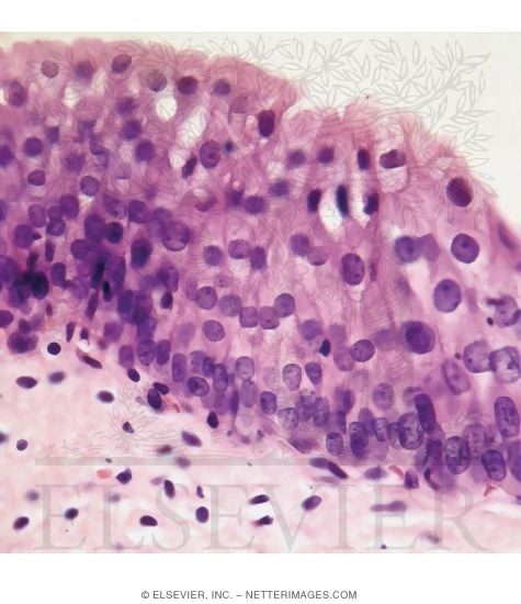 Light Micrograph of Transitional Epithelium In a Contracted Bladder