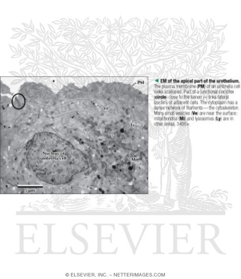 Watermarked preview of labeled image: Electron Micrograph of the Apical Part of the Urothelium