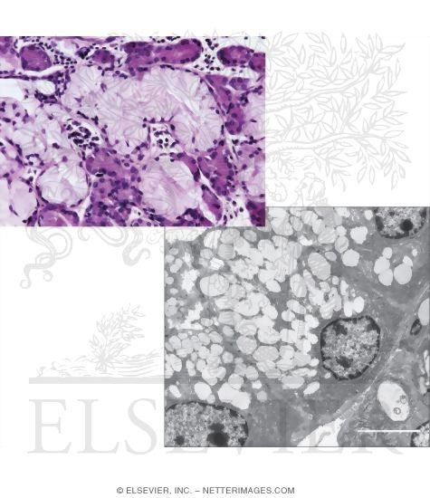 Light Micrograph of Part of a Mixed Seromucous Gland In the Trachea With Electron Micrograph of Part of a Mucous Acinus In a Mixed Salivary Gland