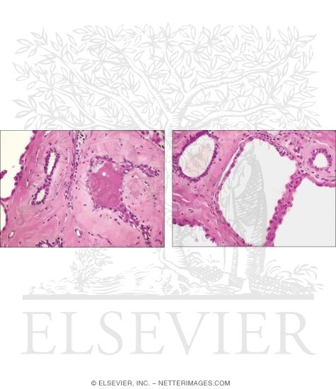 Watermarked preview of unlabeled image: Light Micrographs of a Lactating Mammary Gland