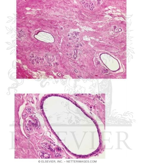 Watermarked preview of unlabeled image: Light Micrograph of an Atrophic Mammary Gland From a Postmenopausal Woman at Low Magnification