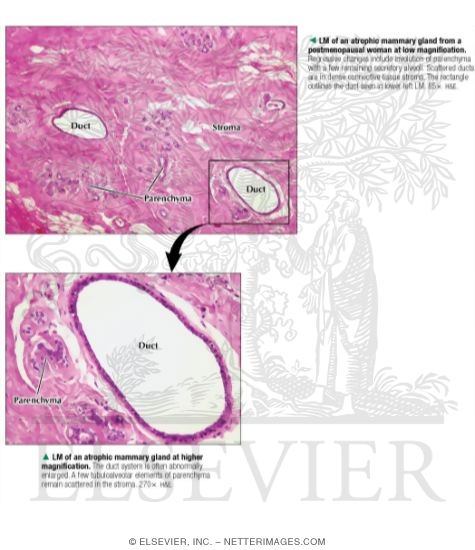 Watermarked preview of labeled image: Light Micrograph of an Atrophic Mammary Gland From a Postmenopausal Woman at Low Magnification