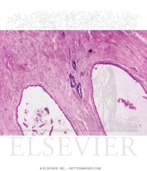 Watermarked preview of unlabeled image: Light Micrograph of an Atrophic Mammary Gland From an Elderly Postmenopausal Woman
