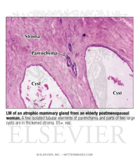 Watermarked preview of labeled image: Light Micrograph of an Atrophic Mammary Gland From an Elderly Postmenopausal Woman