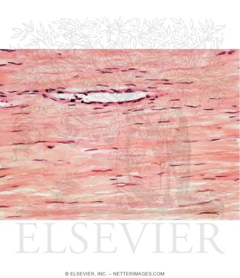 Watermarked preview of unlabeled image: Light Micrograph of Part of a Ligament In Longitudinal Section