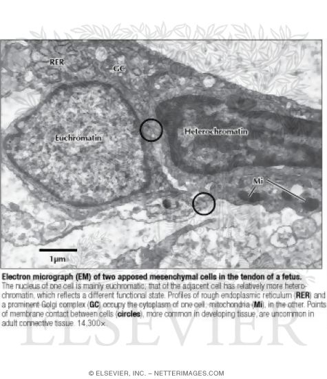 Watermarked preview of labeled image: Electron Micrograph (EM) of Two Apposed Mesenchymal Cells In the Tendon of a Fetus