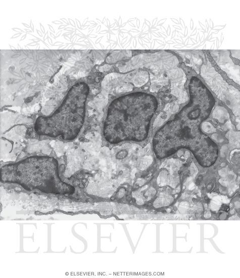 Watermarked preview of unlabeled image: Electron Micrograph of a Growing Tendon During the Adolescent Growth Spurt