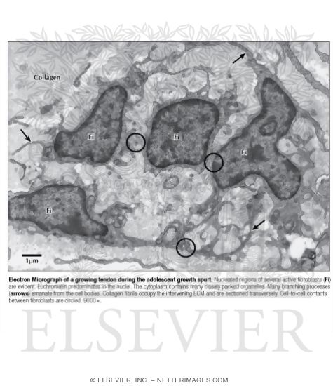 Watermarked preview of labeled image: Electron Micrograph of a Growing Tendon During the Adolescent Growth Spurt