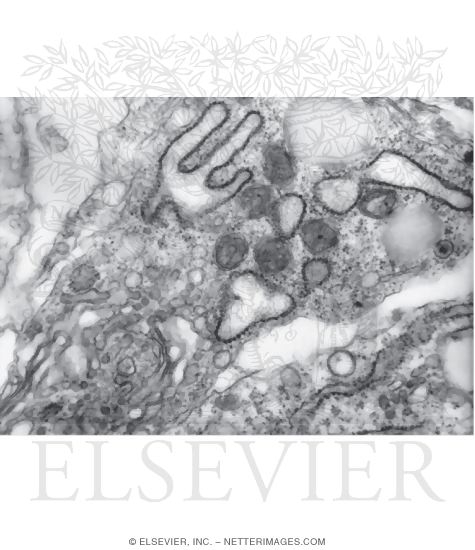 Watermarked preview of unlabeled image: Electron Micrograph Details of Another Active Fibroblast and Its Secretory Organelles