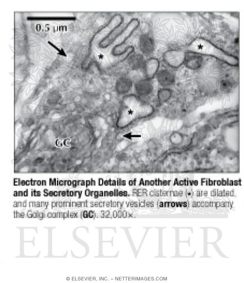 Watermarked preview of labeled image: Electron Micrograph Details of Another Active Fibroblast and Its Secretory Organelles