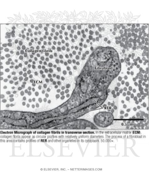 Watermarked preview of labeled image: Electron Micrograph of Collagen Fibrils In Transverse Section