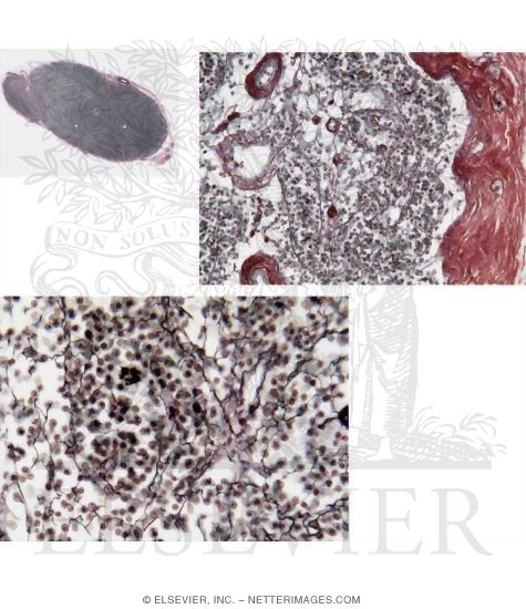 Light Micrograph of a Lymph Node