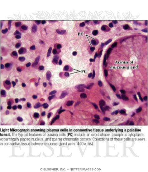 Watermarked preview of labeled image: Light Micrograph Showing Plasma Cells In Connective Tissue Underlying a Palatine
Tonsil