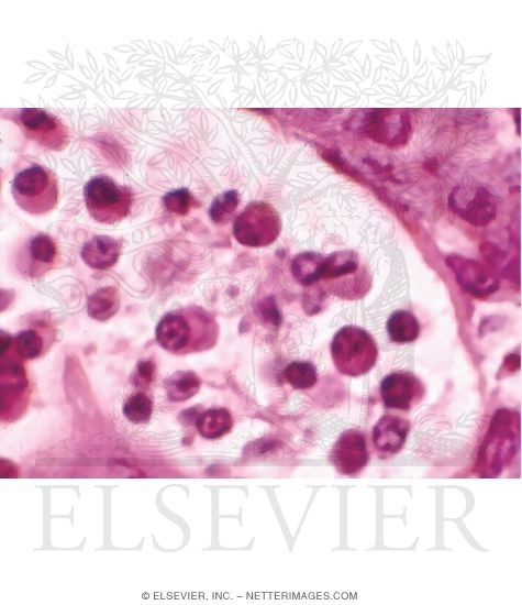 Light Micrograph of Plasma Cells In a Lymph Node