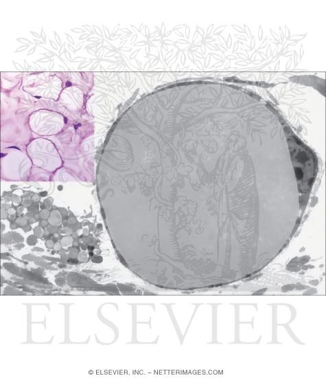 Light Micrograph of Adipocytes In White Adipose Tissue With Electron Micrograph of White (Unilocular) Adipocyte