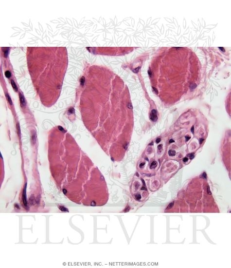 Light Micrograph Of Skeletal Muscle Showing Parts Of Several Muscle Fibers In Transverse Section