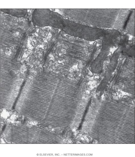 Electron Micrograph of Part of A Skeletal Muscle Fiber In Longitudinal Section